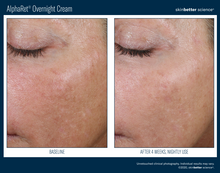 Load image into Gallery viewer, AlphaRet Overnight Cream - 30 ml