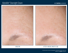 Load image into Gallery viewer, AlphaRet Overnight Cream - 30 ml